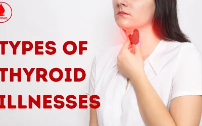 What are the Types of Thyroid Illnesses?
